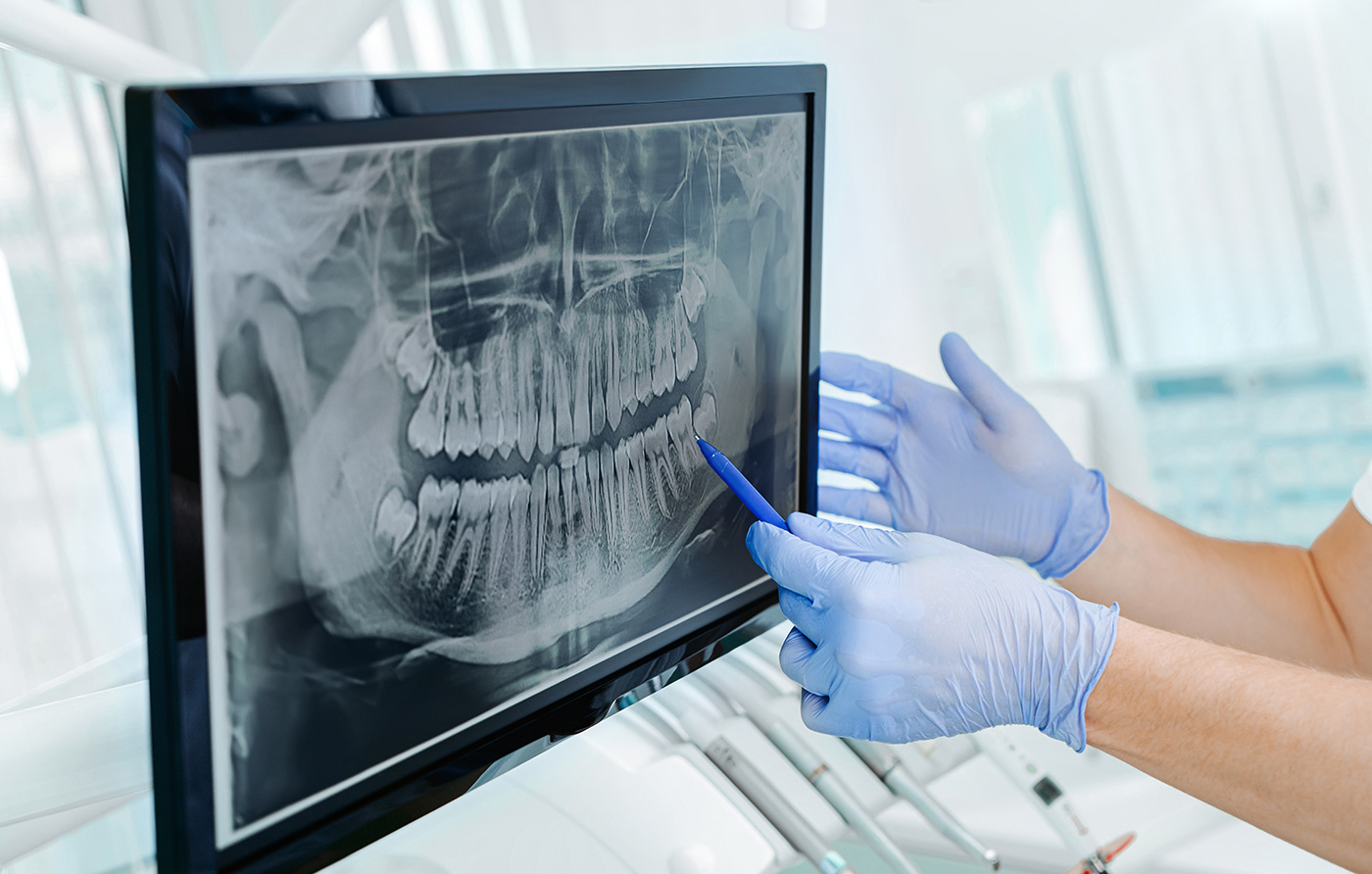 Digital dental technology